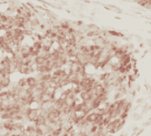 Anti-p120 Catenin antibody - Click Image to Close