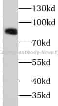 beta-Catenin antibody - Click Image to Close