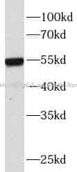 heavy chain Of IgG4 antibody - Click Image to Close