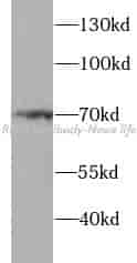 p65/RELA antibody - Click Image to Close