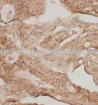 putrescine antibody - Click Image to Close